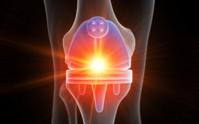 Delaying or Preventing Knee Replacements