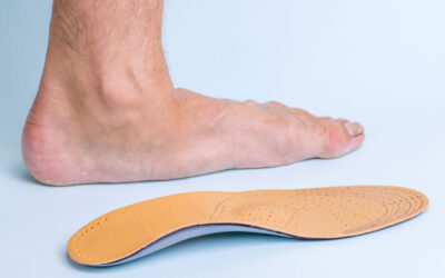Do you really have flat feet?
