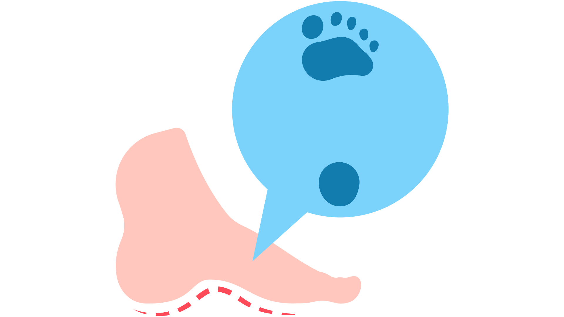 High Arch Feet Illustration illustration of a human foot with a pronounced arch, indicated by a dashed red line. A speech bubble points to the high arch.
